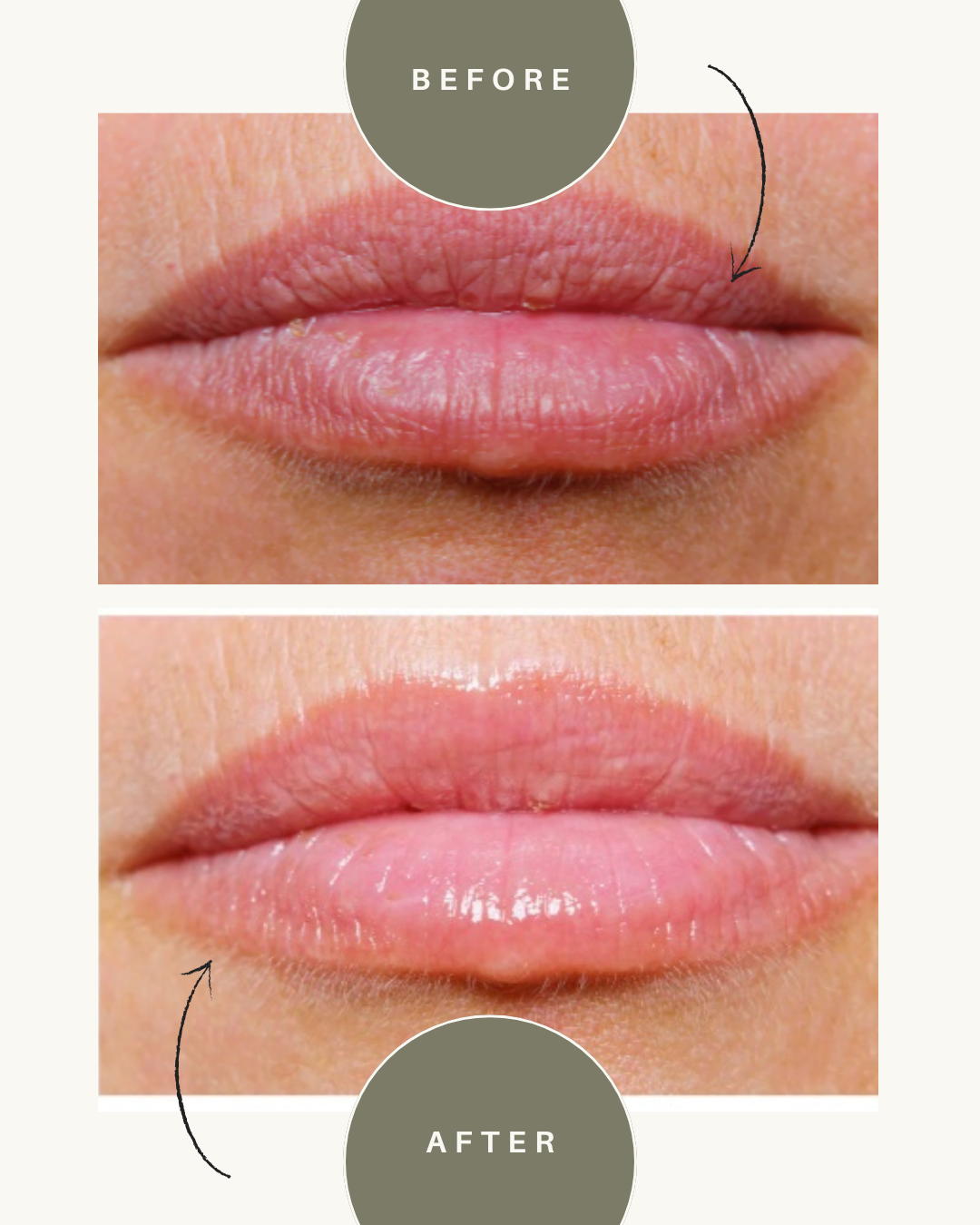 LIPSMART Hydrating Lip Treatment