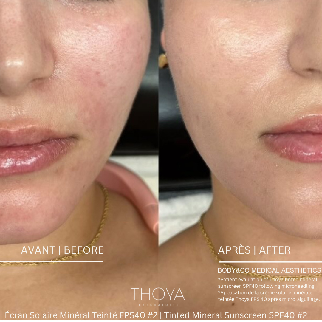 Crème solaire minérale teintée naturelle n° 2 FPS 40 Thoya Laboratoire