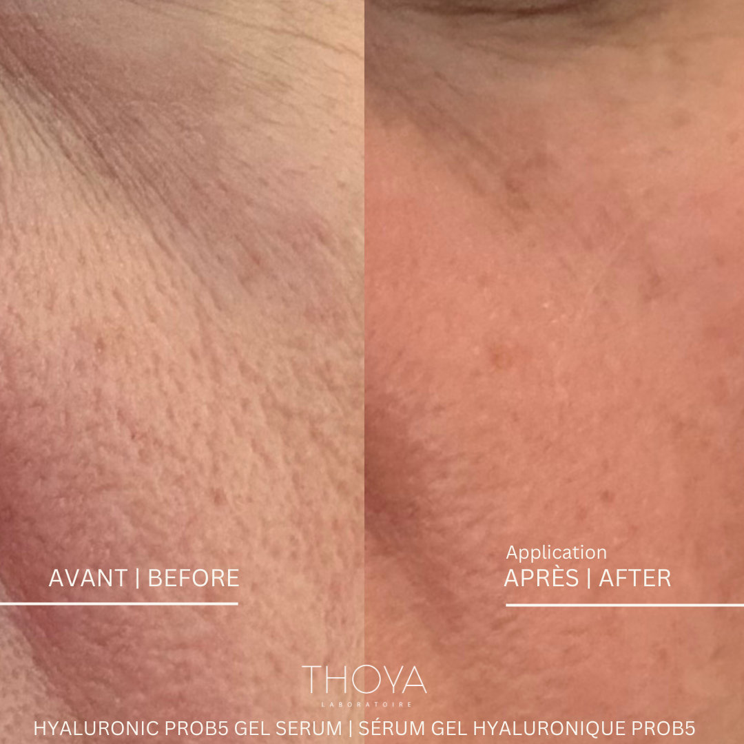 Thoya Hyaluronic ProB5 Gel Serum - Elastin, Provitamin B5 and Hyaluronic Acid in three molecular weights