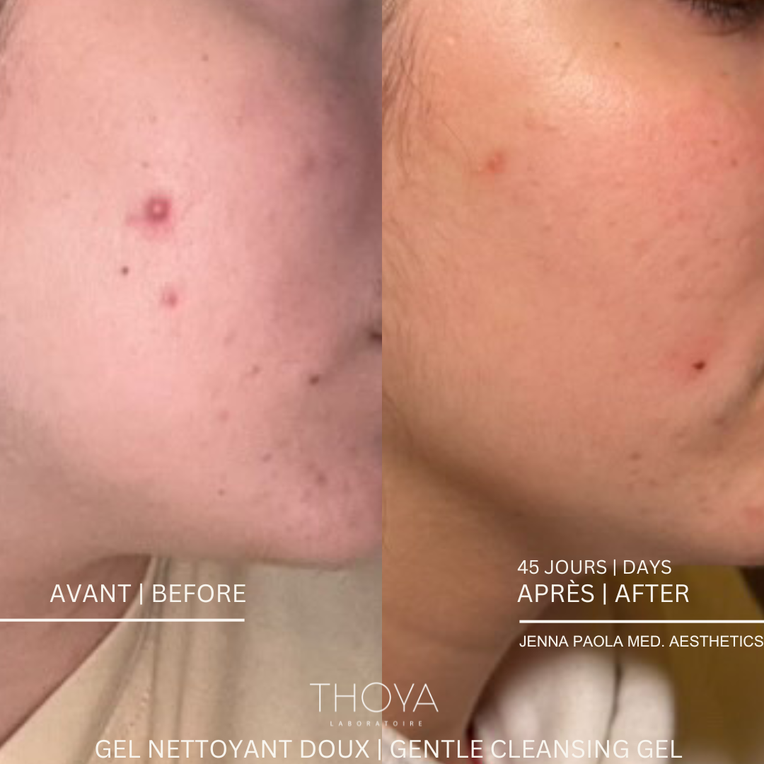 Gentle Cleansing Gel - antioxidants + superfruit elderberry