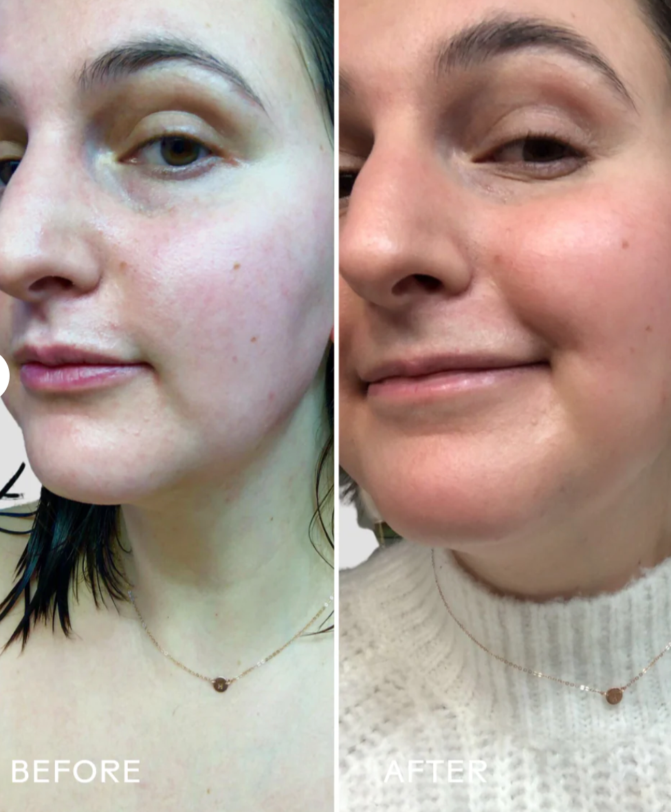 Three Ships SkinHero™ Calendula + 2 % de sérum bio-rétinol Bakuchiol