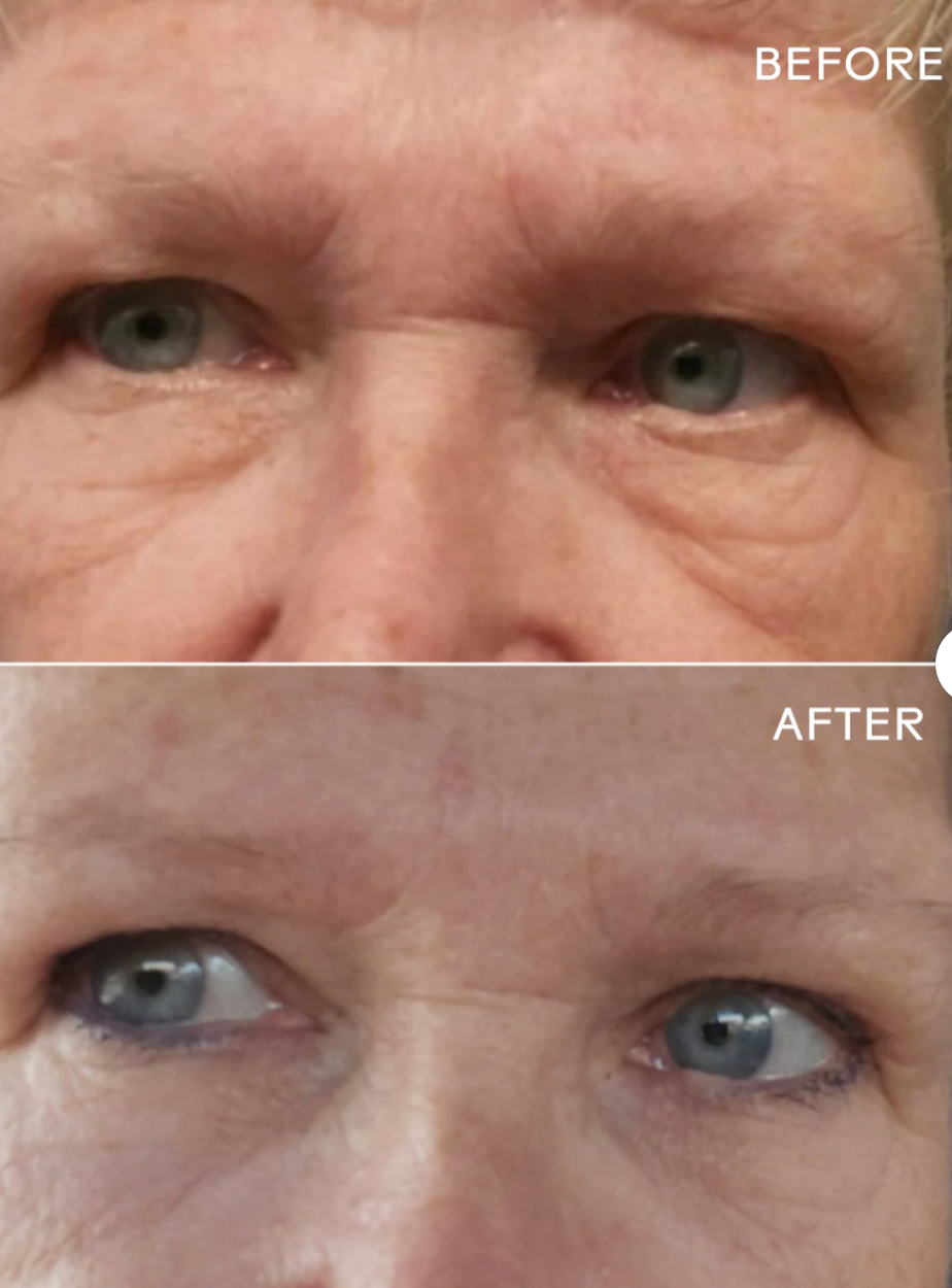 EyeHero™ de Three Ships - Crème contour des yeux lissante au bio-rétinol