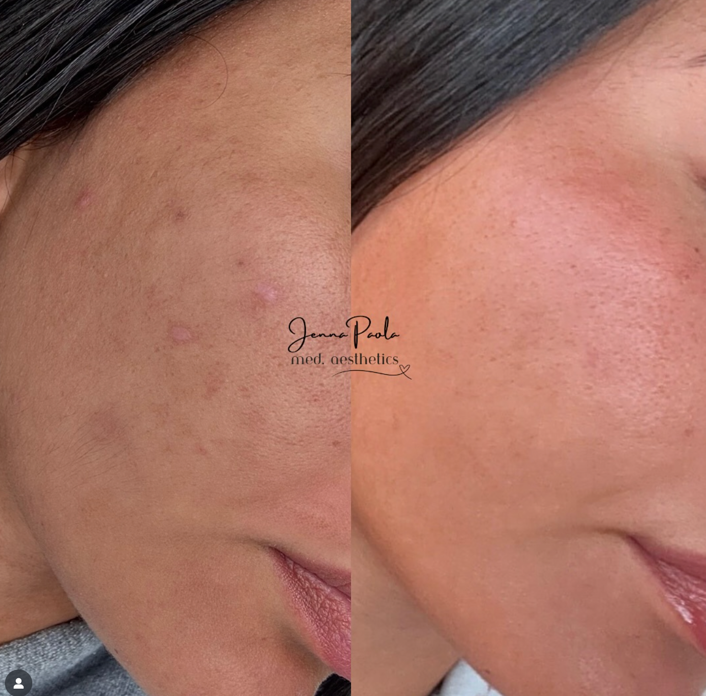 Moisturizing Cleansing Gel- patented oleosome technology + antioxidants