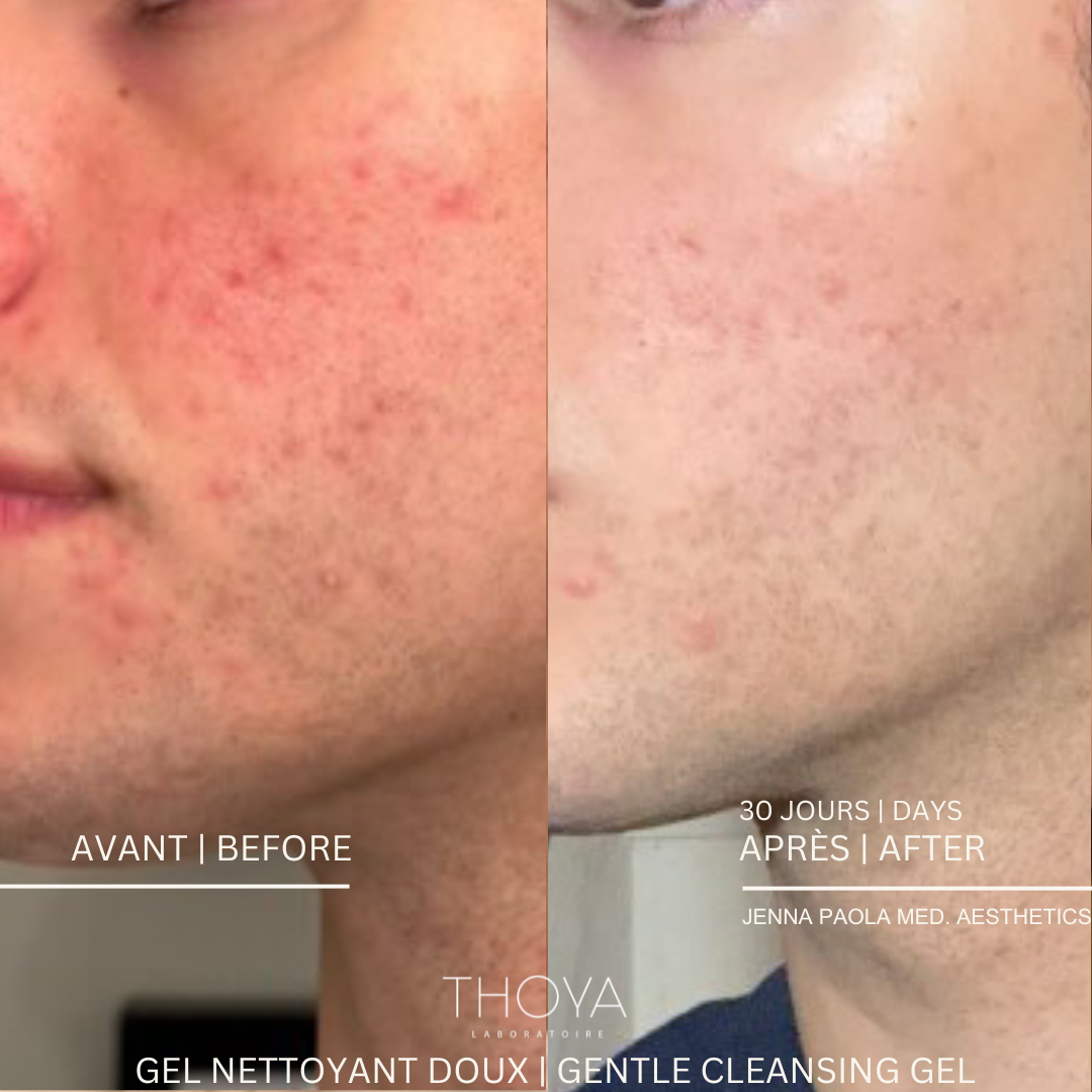Gentle Cleansing Gel - antioxidants + superfruit elderberry