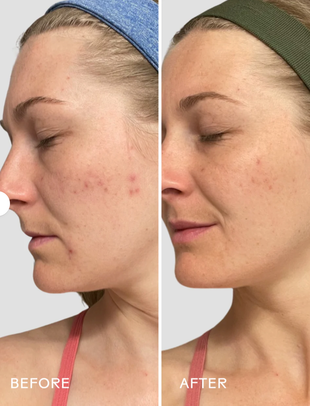 Three Ships Refresh Papaya + Salicylic Acid Foaming Cleanser