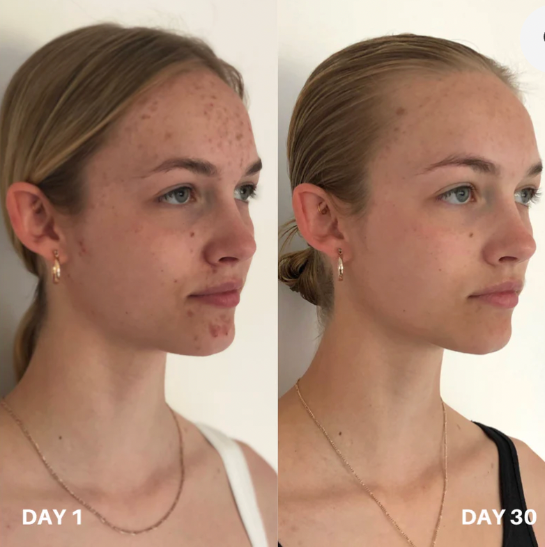 Clinisoothe+ Purifiant pour la peau - Solution hypochloreuse de haute pureté