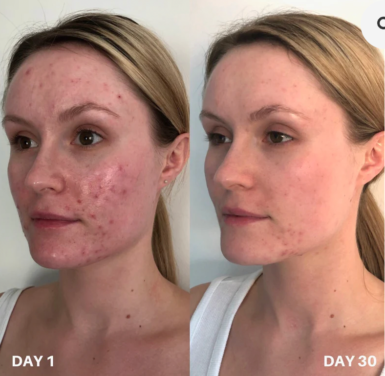 Clinisoothe+ Purifiant pour la peau - Solution hypochloreuse de haute pureté