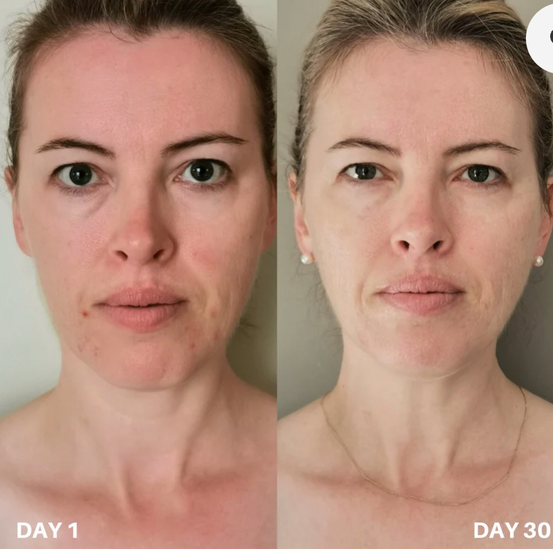 Clinisoothe+ Purifiant pour la peau - Solution hypochloreuse de haute pureté