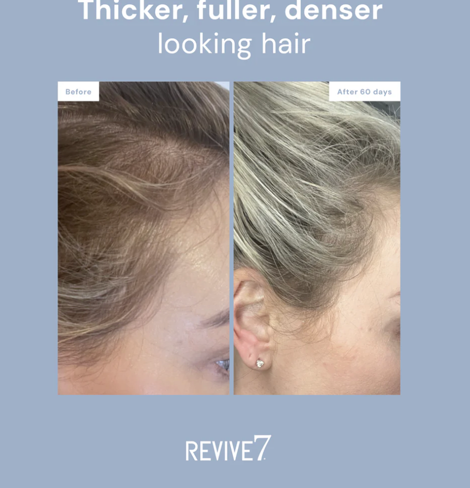 Traitement capillaire Revive7